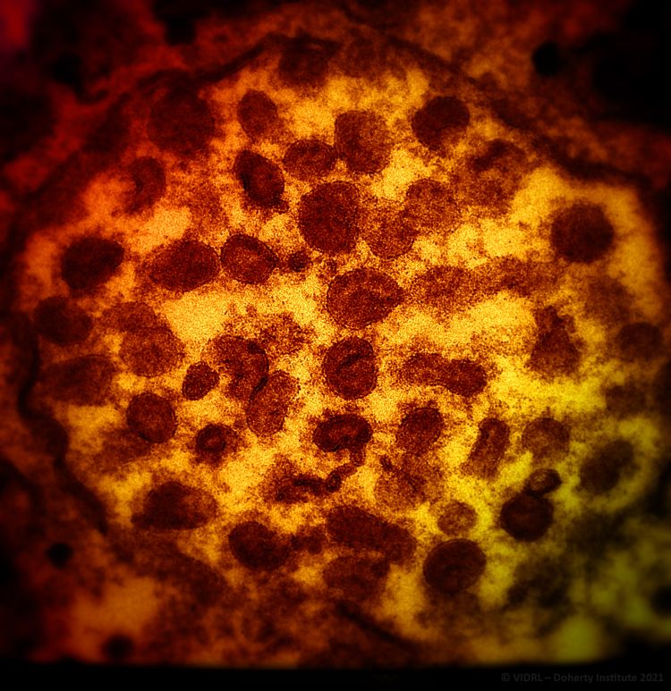 COVID-19 Virus Under the Microscope